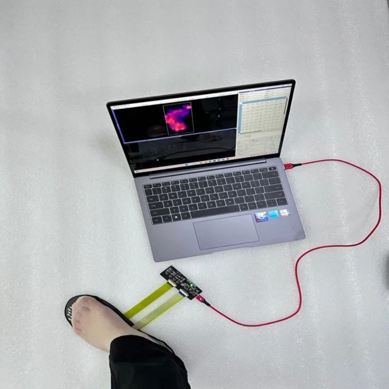 مستشعر ضغط القدم متعدد المناطق - مراجعة Smart Insole Pressure وسعره